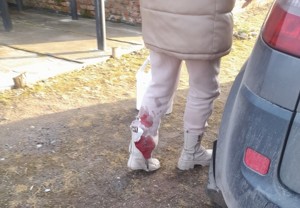 Великолучанке пришлось отбиваться от агрессивной собаки, чтобы защитить ...
